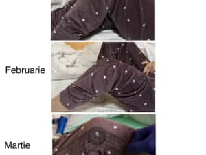 Kinetoterapie la Domiciliu — miniatura 5