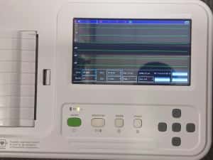 Amanet F28: Electrocardiografe Contec 600 G — miniatura 2
