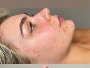 Extensii gene, micropigmentari sprancene, tratamente faciale & corpora — miniatura 6